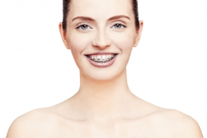Braces Woman - blog